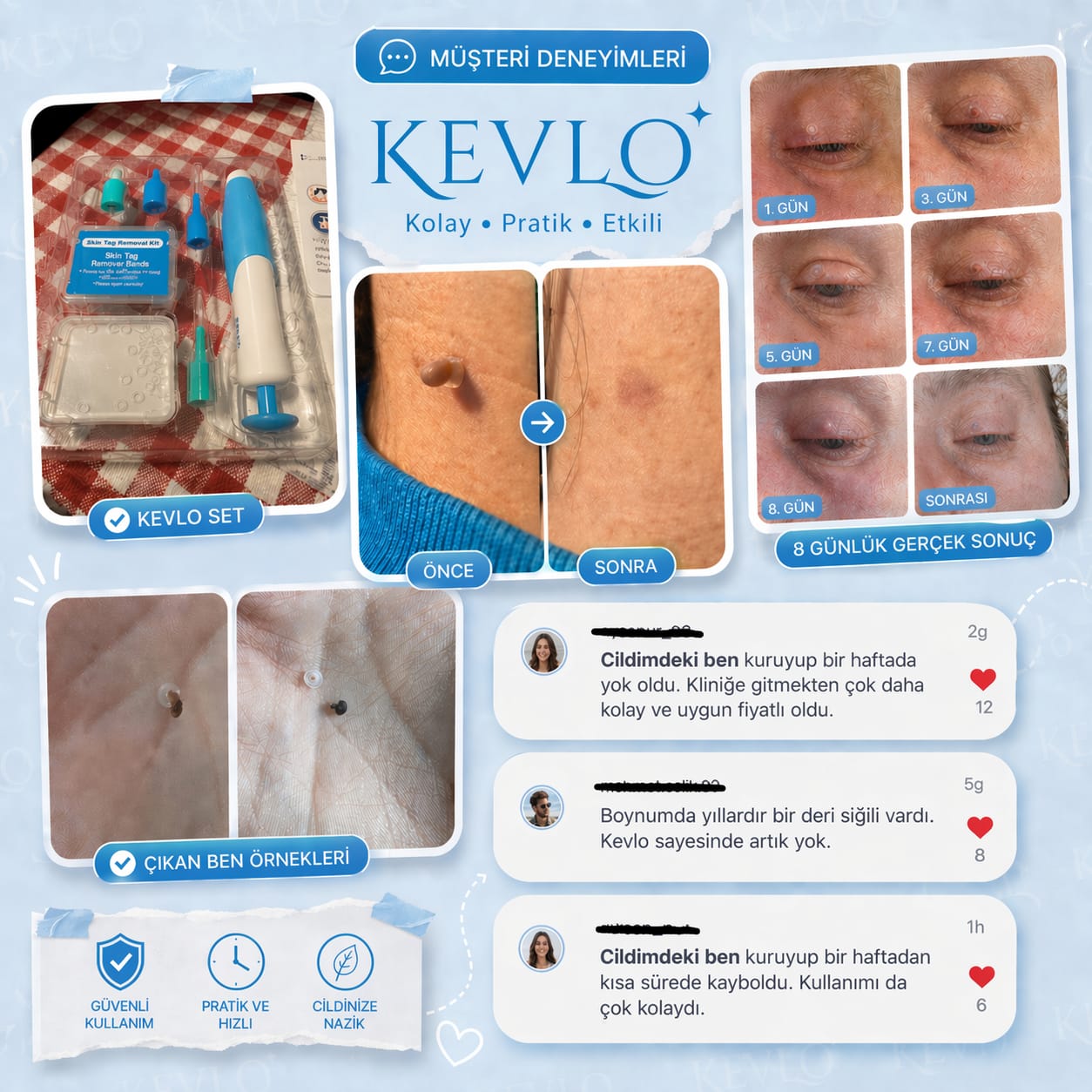 TagBuddy Kiti – Artık Cilt Lezyonlarına Son!