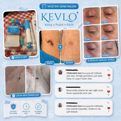 TagBuddy Kiti – Artık Cilt Lezyonlarına Son!