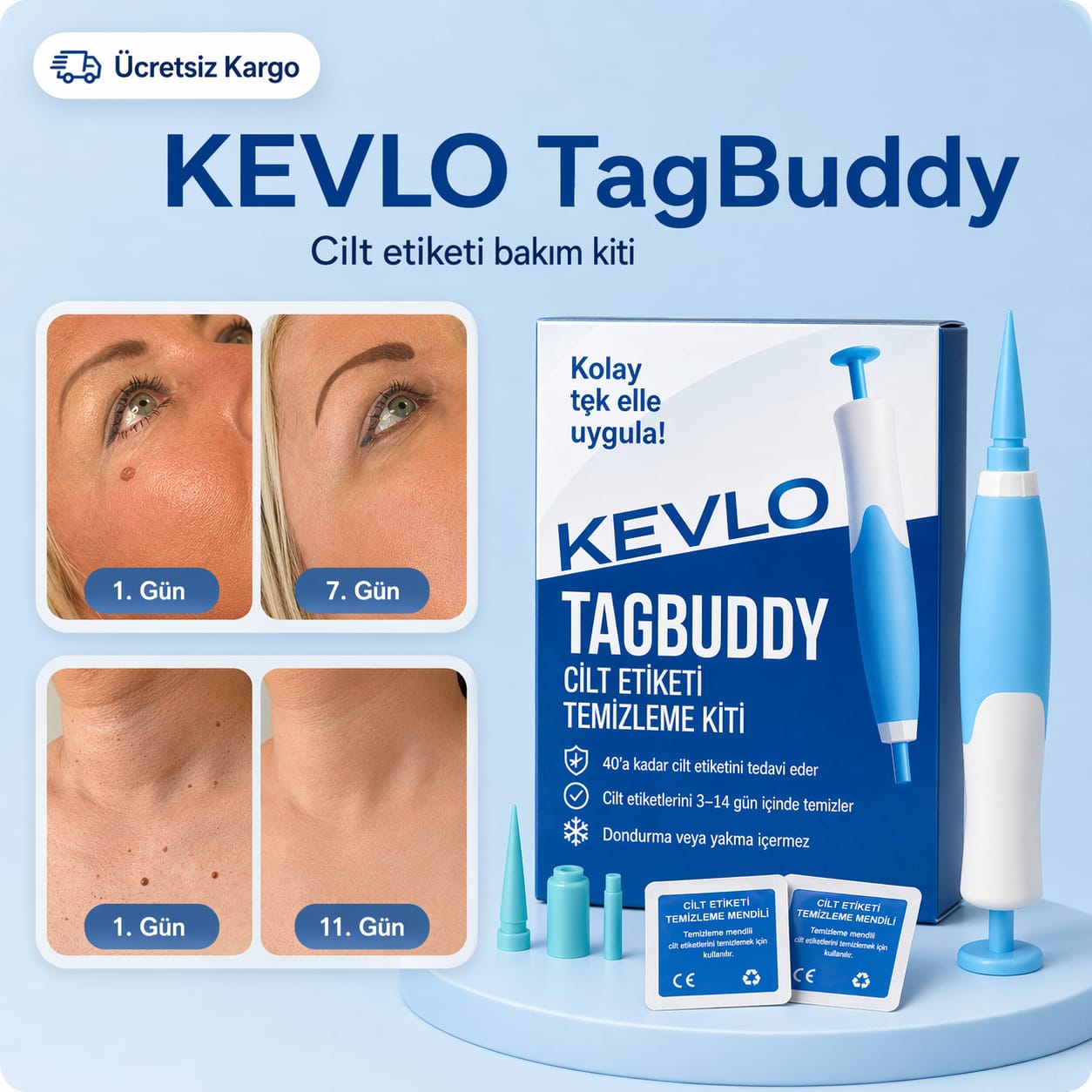 TagBuddy Kiti – Artık Cilt Lezyonlarına Son!