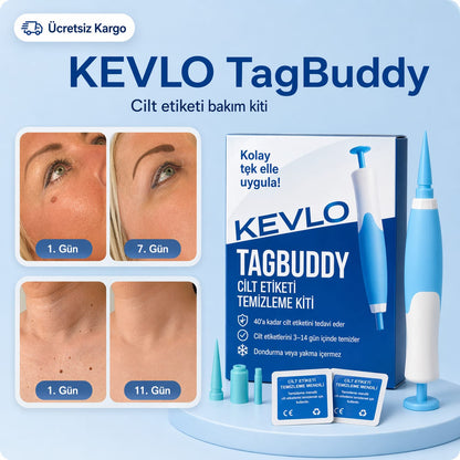 TagBuddy Kiti – Artık Cilt Lezyonlarına Son!